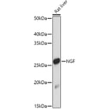 Western Blot - Anti-NGF Antibody (A92198) - Antibodies.com