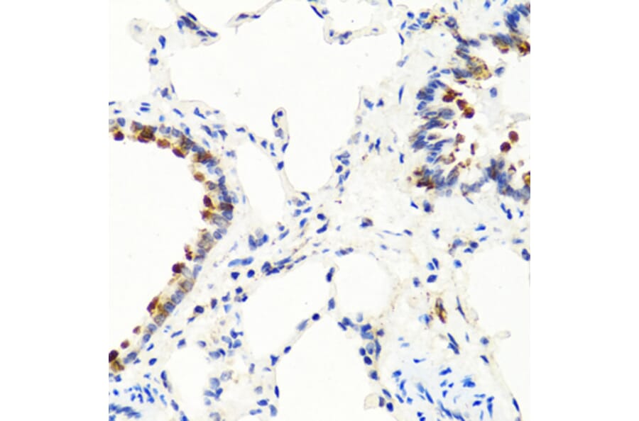 Immunohistochemistry - Anti-NTF3 Antibody (A12475) - Antibodies.com
