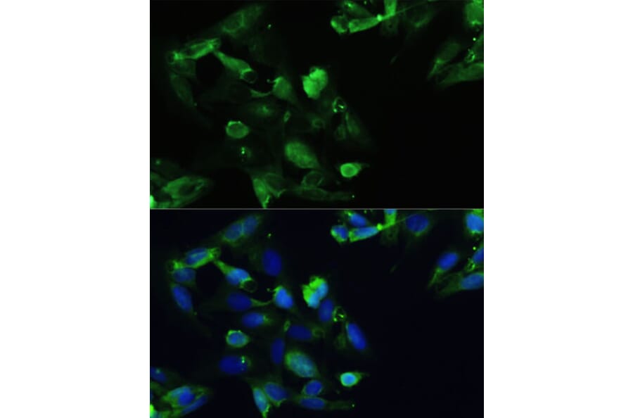 Immunofluorescence - Anti-CXCR5 Antibody (A14233) - Antibodies.com