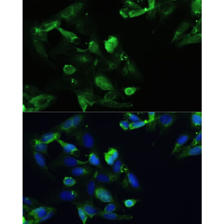 Immunofluorescence - Anti-CXCR5 Antibody (A14233) - Antibodies.com