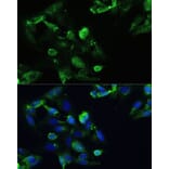 Immunofluorescence - Anti-CXCR5 Antibody (A14233) - Antibodies.com