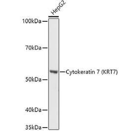 Western Blot - Anti-Cytokeratin 7 Antibody (A92201) - Antibodies.com
