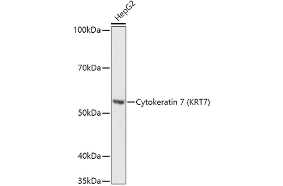 Western Blot - Anti-Cytokeratin 7 Antibody (A92201) - Antibodies.com