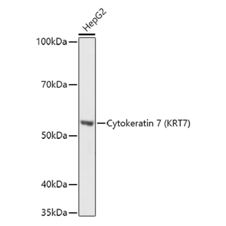 Western Blot - Anti-Cytokeratin 7 Antibody (A92201) - Antibodies.com