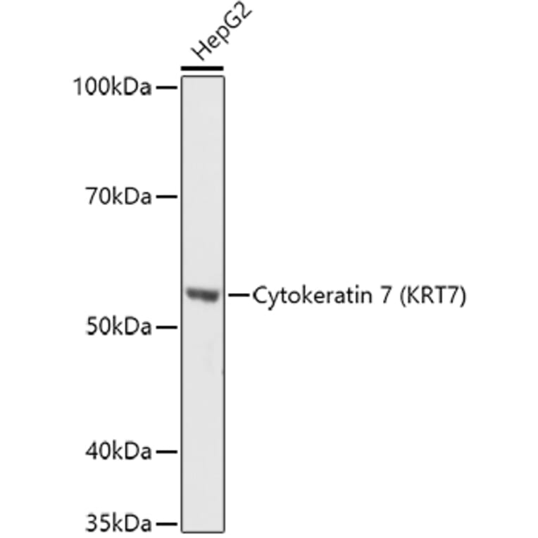 Western Blot - Anti-Cytokeratin 7 Antibody (A92201) - Antibodies.com