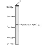 Western Blot - Anti-Cytokeratin 7 Antibody (A92201) - Antibodies.com