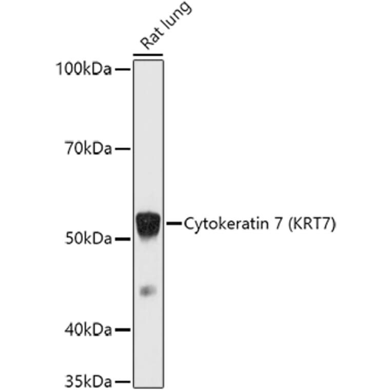 Western Blot - Anti-Cytokeratin 7 Antibody (A92201) - Antibodies.com