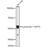 Western Blot - Anti-Cytokeratin 7 Antibody (A92201) - Antibodies.com