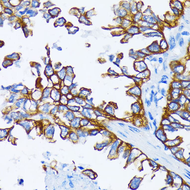 Immunohistochemistry - Anti-Cytokeratin 7 Antibody (A92201) - Antibodies.com