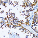 Immunohistochemistry - Anti-Cytokeratin 7 Antibody (A92201) - Antibodies.com