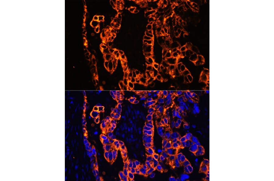 Immunofluorescence - Anti-Cytokeratin 7 Antibody (A92201) - Antibodies.com