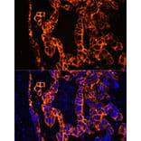 Immunofluorescence - Anti-Cytokeratin 7 Antibody (A92201) - Antibodies.com