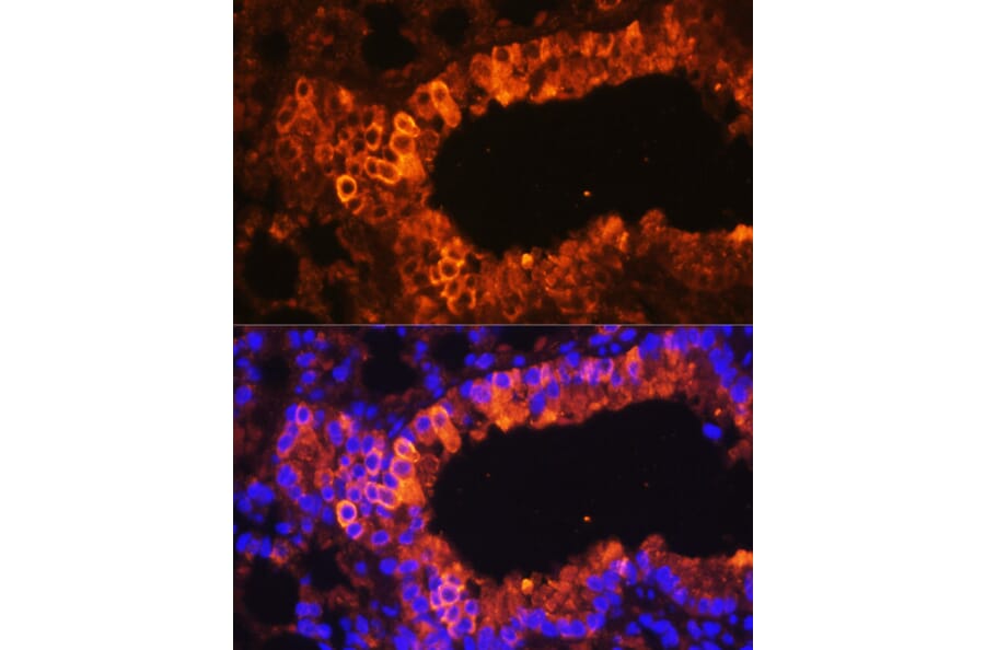 Immunofluorescence - Anti-Cytokeratin 7 Antibody (A92201) - Antibodies.com