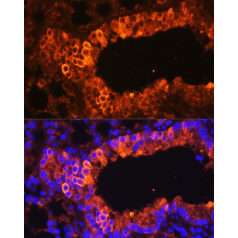 Immunofluorescence - Anti-Cytokeratin 7 Antibody (A92201) - Antibodies.com