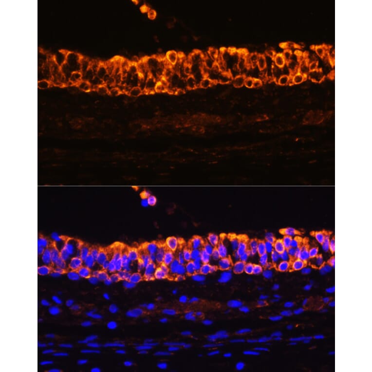 Immunofluorescence - Anti-Cytokeratin 7 Antibody (A92201) - Antibodies.com