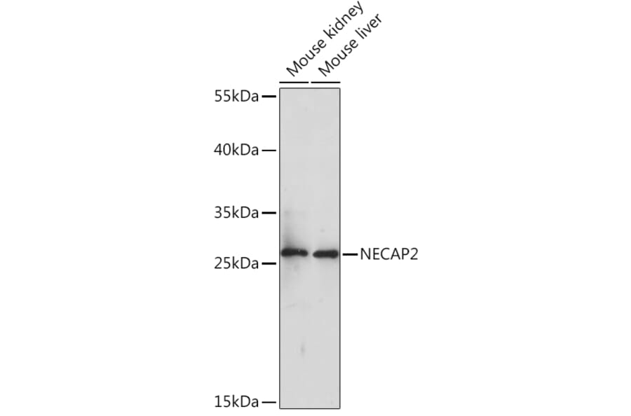 Western Blot - Anti-NECAP2 Antibody (A92203) - Antibodies.com