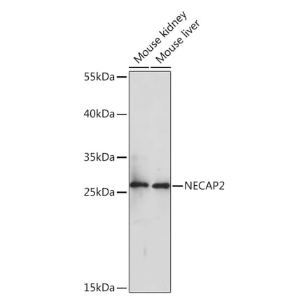 Western Blot - Anti-NECAP2 Antibody (A92203) - Antibodies.com