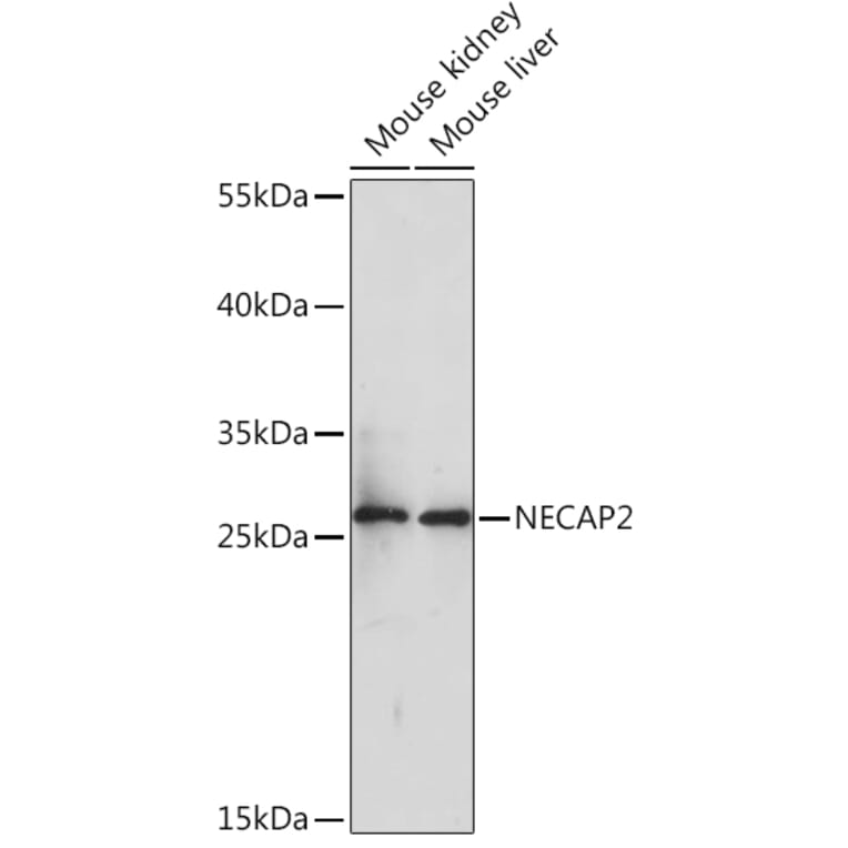Western Blot - Anti-NECAP2 Antibody (A92203) - Antibodies.com