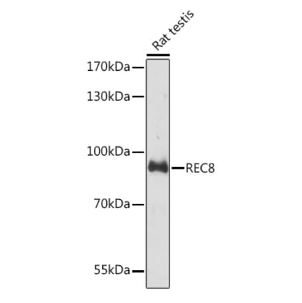 Western Blot - Anti-REC8 Antibody (A92204) - Antibodies.com