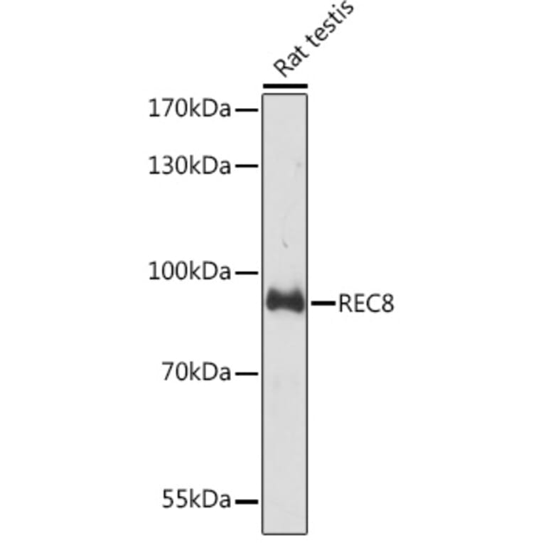 Western Blot - Anti-REC8 Antibody (A92204) - Antibodies.com