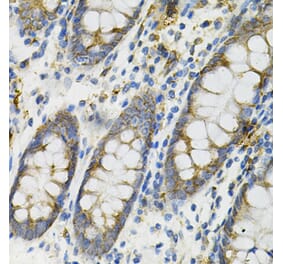 Immunohistochemistry - Anti-DEFB132 Antibody (A92205) - Antibodies.com
