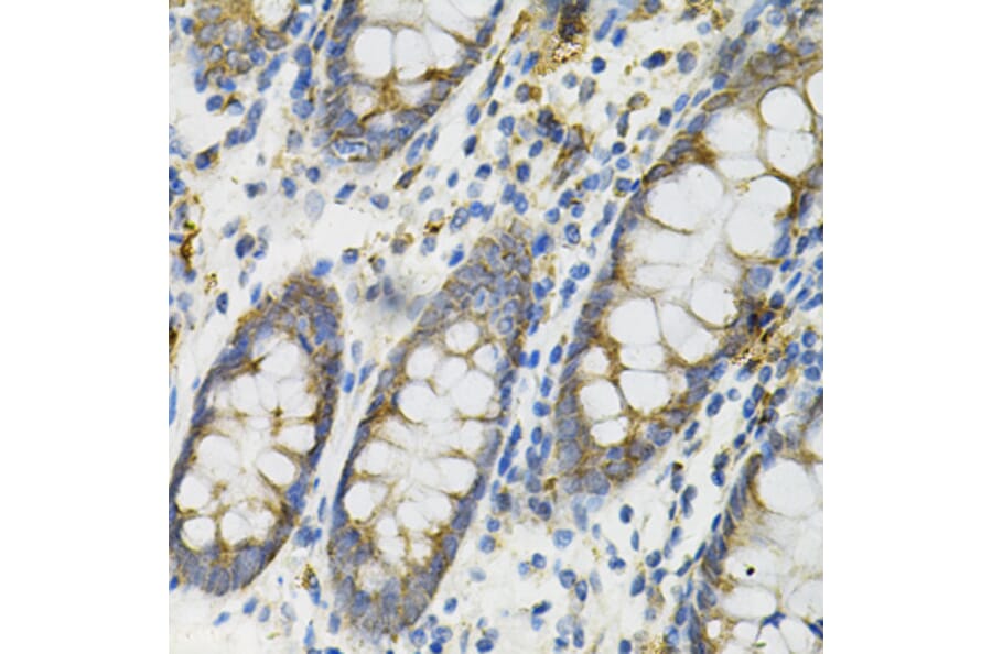 Immunohistochemistry - Anti-DEFB132 Antibody (A92205) - Antibodies.com