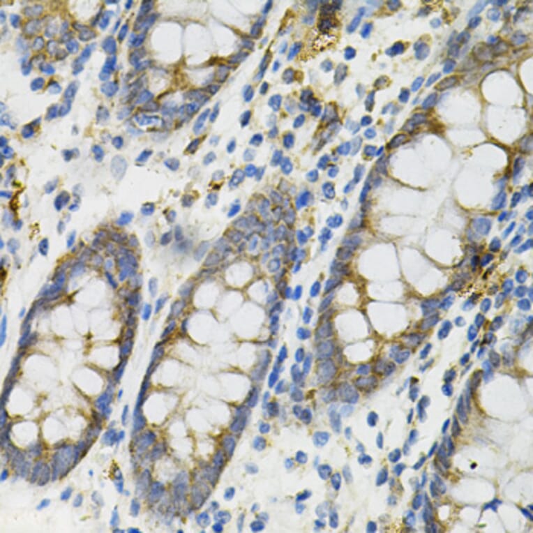 Immunohistochemistry - Anti-DEFB132 Antibody (A92205) - Antibodies.com