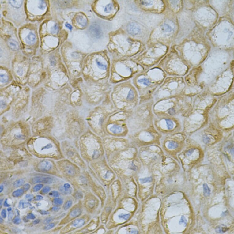 Immunohistochemistry - Anti-DEFB132 Antibody (A92205) - Antibodies.com