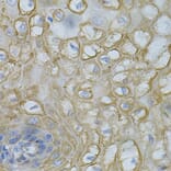 Immunohistochemistry - Anti-DEFB132 Antibody (A92205) - Antibodies.com
