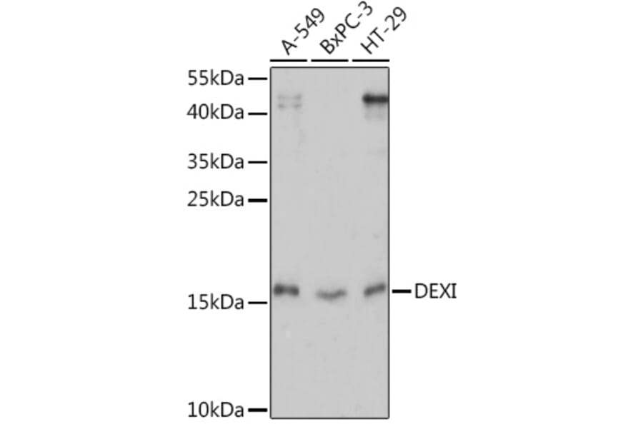 Western Blot - Anti-DEXI Antibody (A92206) - Antibodies.com