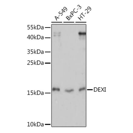 Western Blot - Anti-DEXI Antibody (A92206) - Antibodies.com