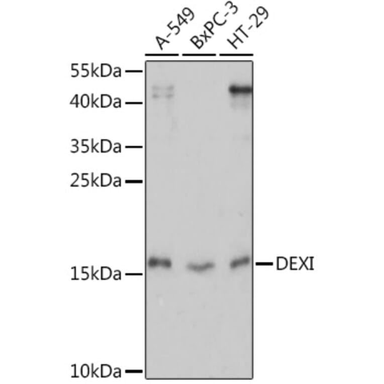 Western Blot - Anti-DEXI Antibody (A92206) - Antibodies.com