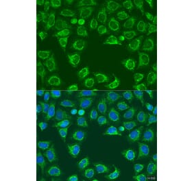 Immunofluorescence - Anti-ALG2 Antibody (A92212) - Antibodies.com