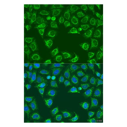 Immunofluorescence - Anti-ALG2 Antibody (A92212) - Antibodies.com