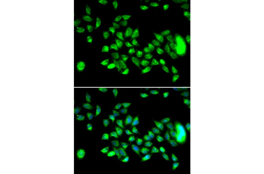 Immunofluorescence - Anti-HYAL3 Antibody (A14075) - Antibodies.com