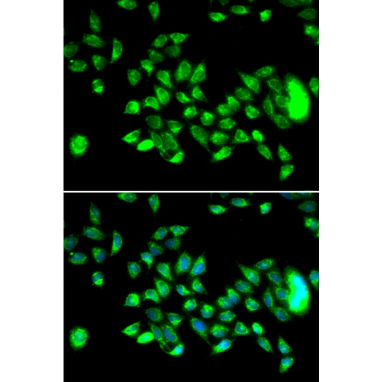 Immunofluorescence - Anti-HYAL3 Antibody (A14075) - Antibodies.com
