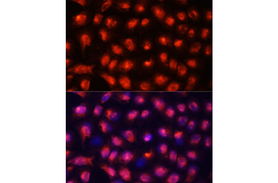 Immunofluorescence - Anti-ACYP1 Antibody (A15021) - Antibodies.com