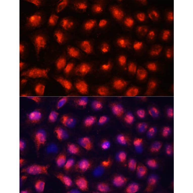 Immunofluorescence - Anti-ACYP1 Antibody (A15021) - Antibodies.com
