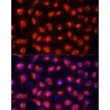 Immunofluorescence - Anti-ACYP1 Antibody (A15021) - Antibodies.com