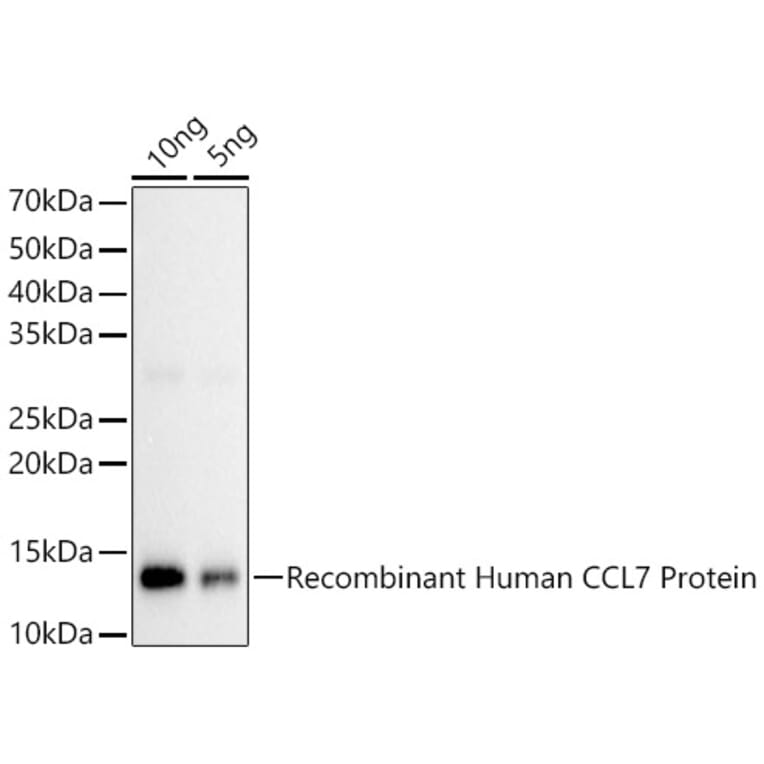 Western Blot - Anti-MCP3 Antibody (A92215) - Antibodies.com