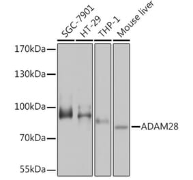 Western Blot - Anti-ADAM28 Antibody (A92216) - Antibodies.com