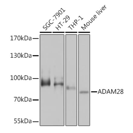 Western Blot - Anti-ADAM28 Antibody (A92216) - Antibodies.com