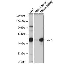 Western Blot - Anti-ADK Antibody (A92220) - Antibodies.com