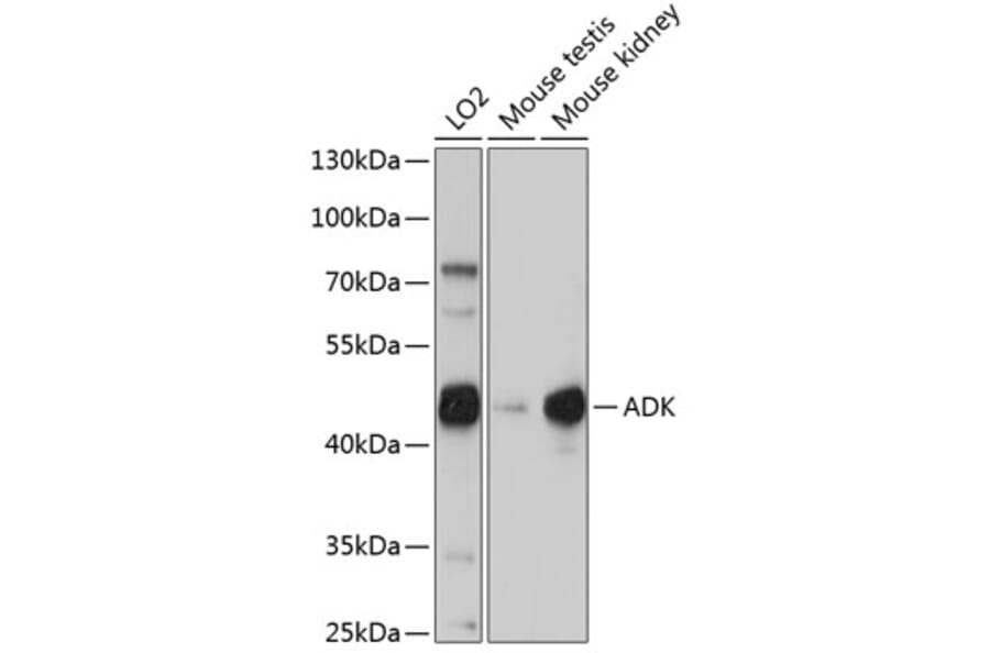 Western Blot - Anti-ADK Antibody (A92220) - Antibodies.com