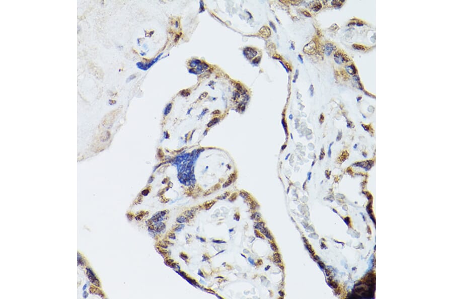 Immunohistochemistry - Anti-ADK Antibody (A92220) - Antibodies.com