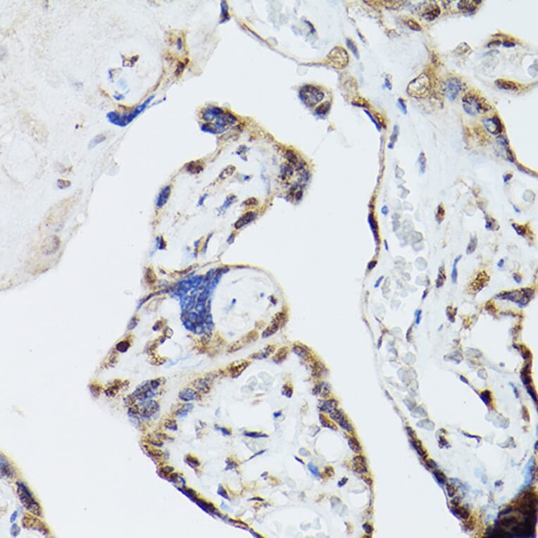 Immunohistochemistry - Anti-ADK Antibody (A92220) - Antibodies.com