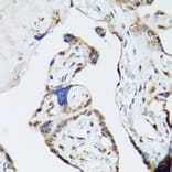 Immunohistochemistry - Anti-ADK Antibody (A92220) - Antibodies.com