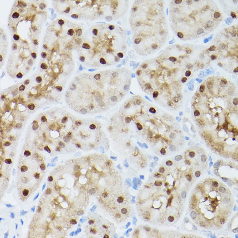 Immunohistochemistry - Anti-ADK Antibody (A92220) - Antibodies.com