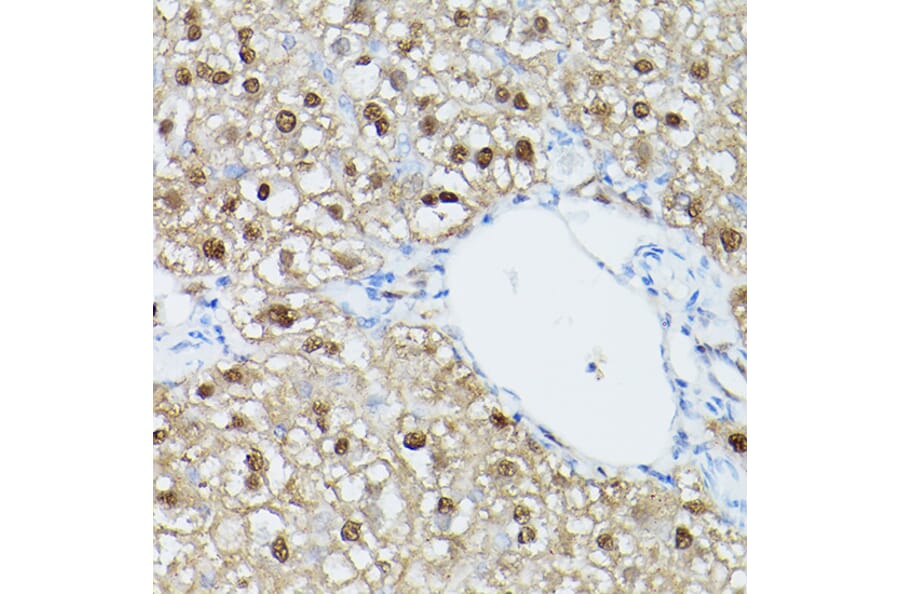 Immunohistochemistry - Anti-ADK Antibody (A92220) - Antibodies.com