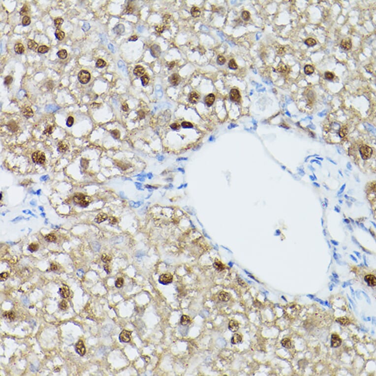 Immunohistochemistry - Anti-ADK Antibody (A92220) - Antibodies.com